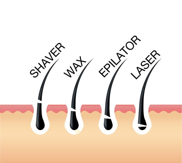 Laser Hair Reduction Treatment in Bangalore - Dr. Shetty's Cosmetic Clinic Laser Hair Reduction Treatment in Bangalore - Dr. Shetty's Cosmetic Clinic