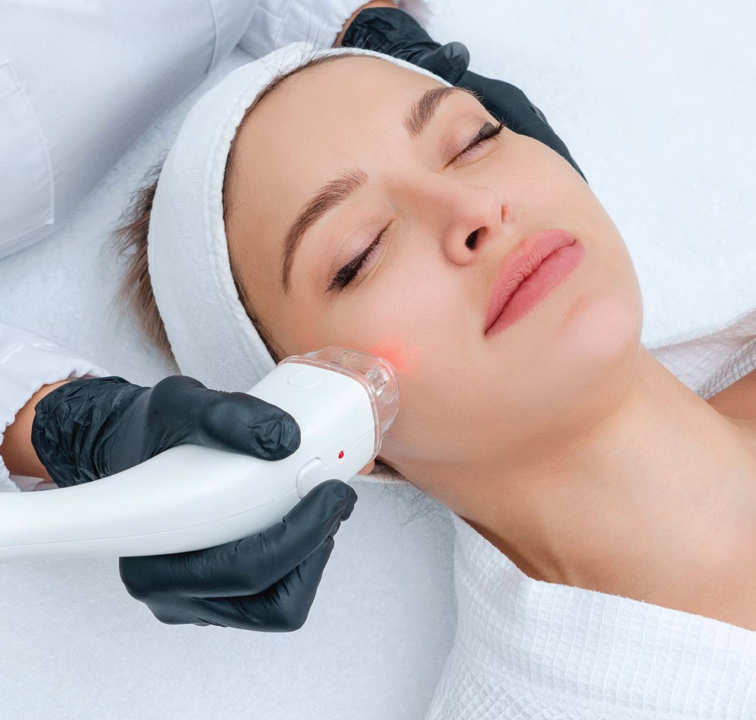CO2 Laser Multiple session