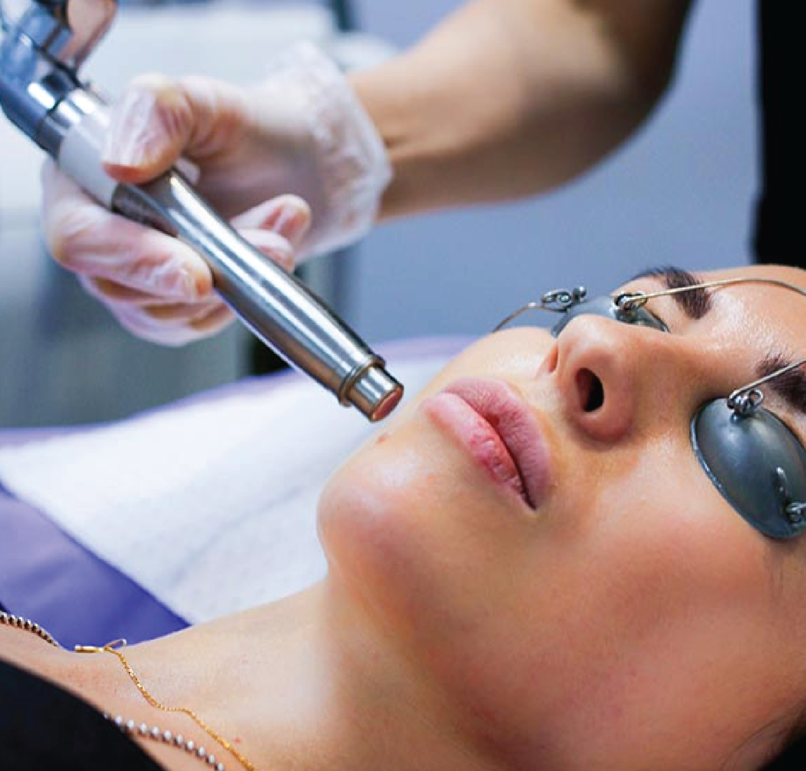 Erbium YAG Laser