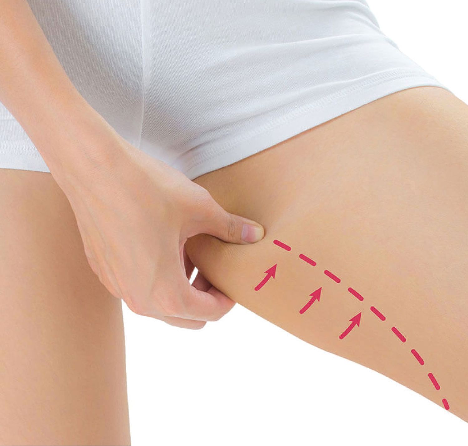 InnerThighLift