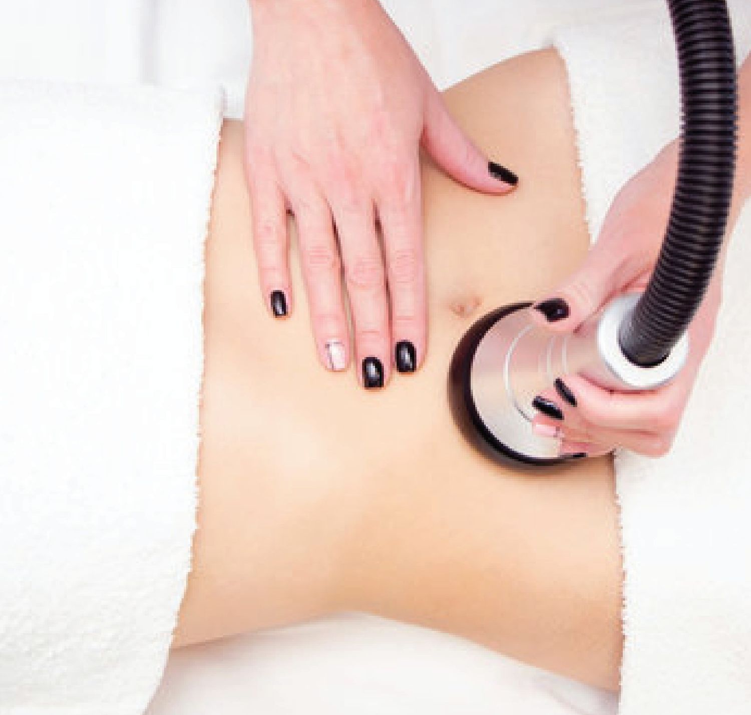 Laser Assisted Liposuction SmartLipo