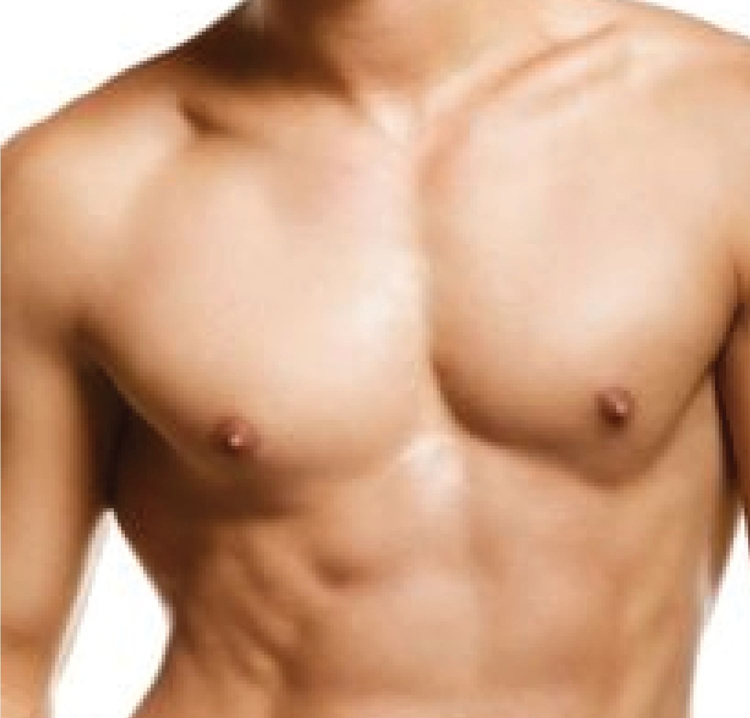 Liposuction 3