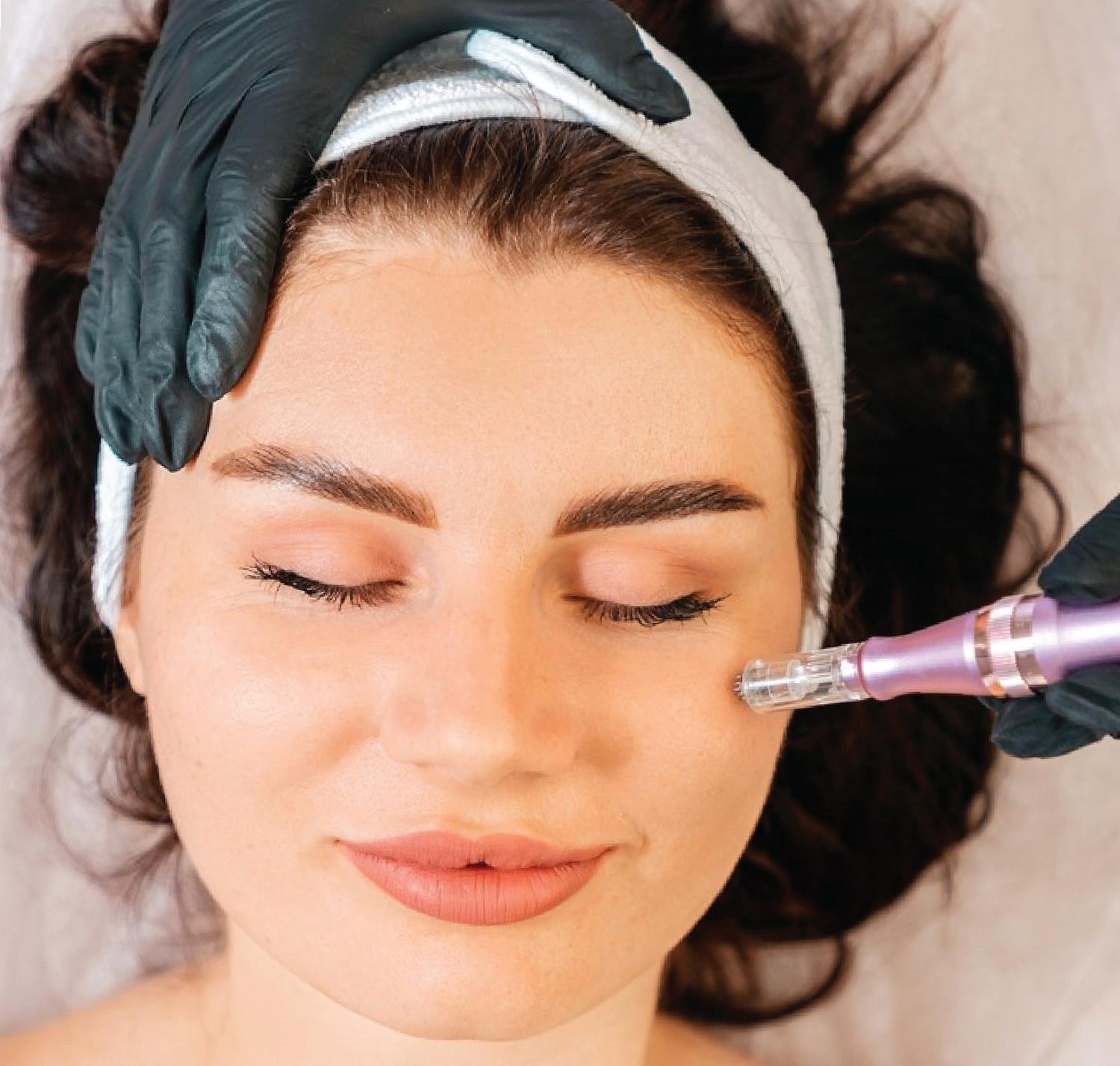 Microneedling Radio Frequency MNRF Morpheus