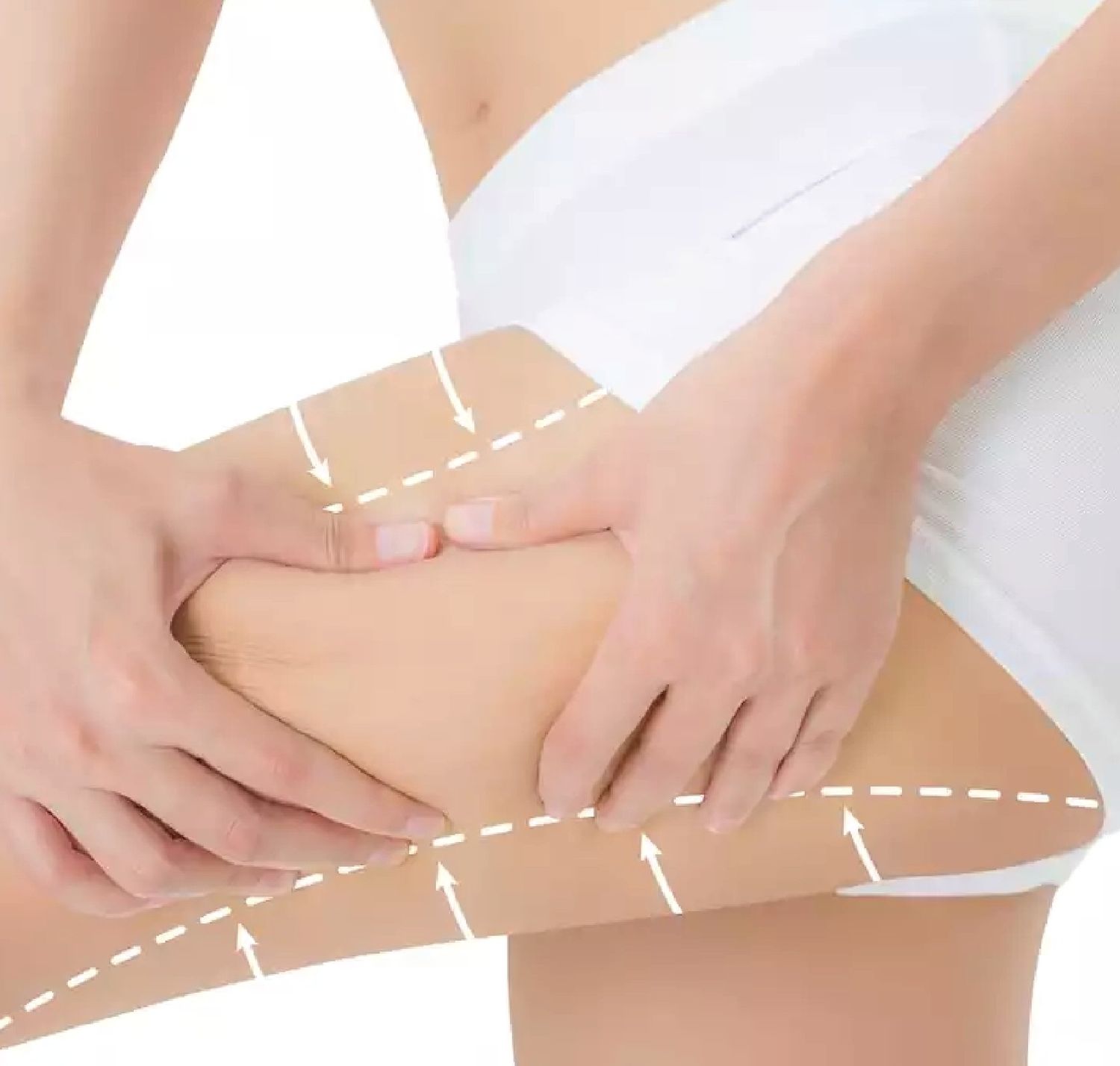 OuterThighLift
