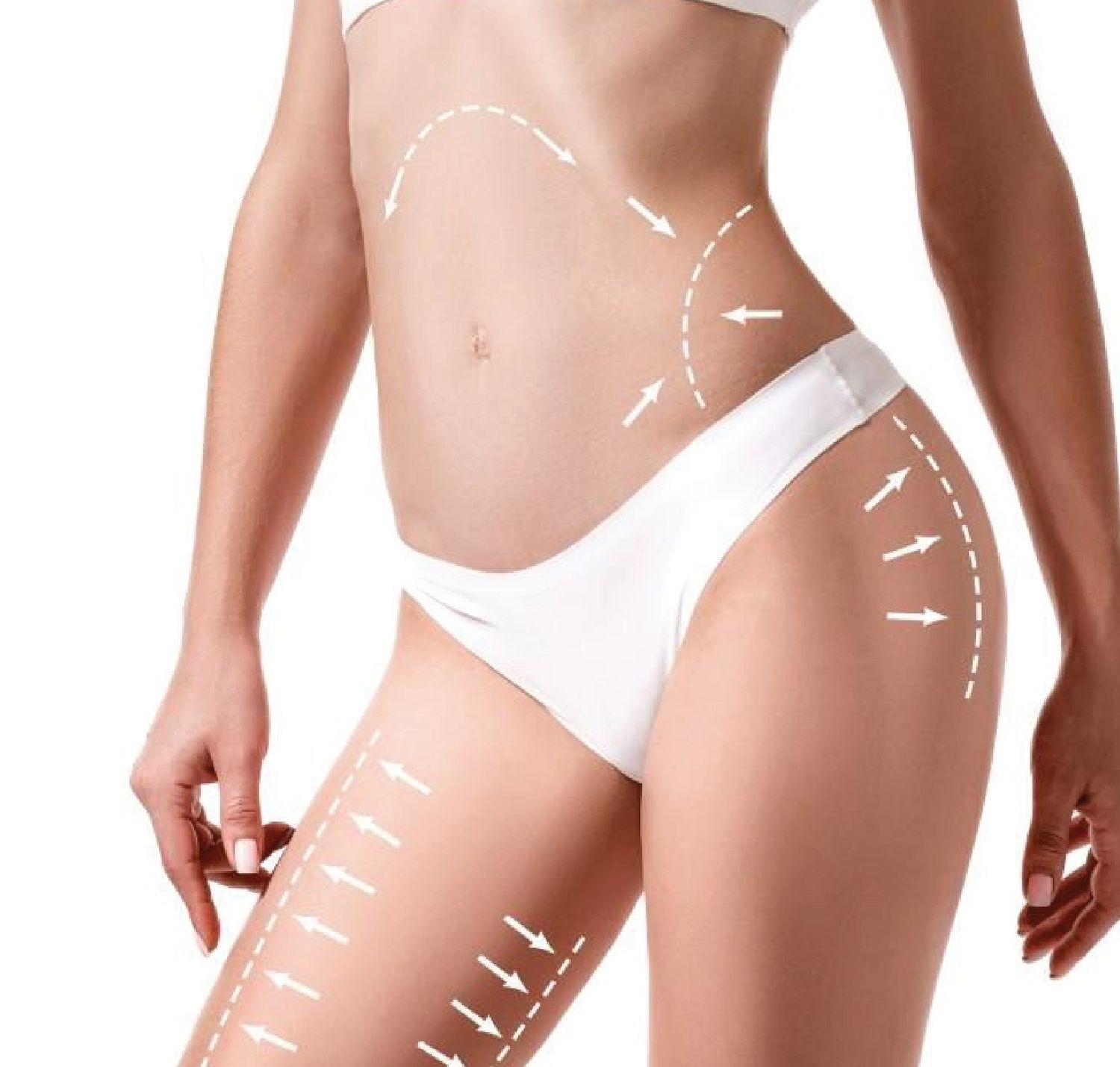 Tumescent Liposuction