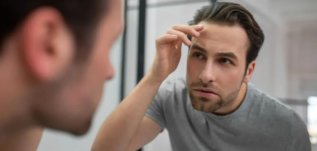 How Long Does a Hair Transplant Last How Long Does a Hair Transplant Last
