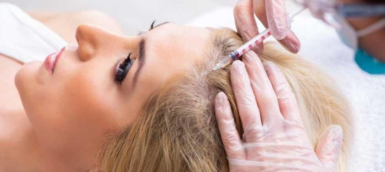 Advantages and Disadvantages of PRP Hair Treatment  Is It Right for You