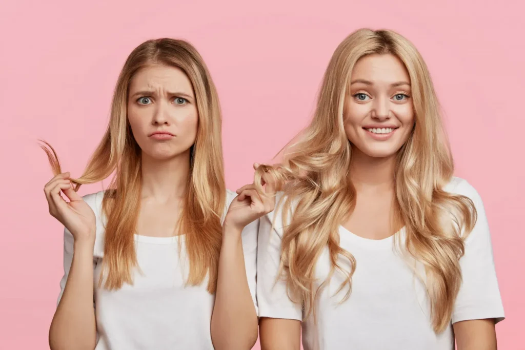 Dos and Don’ts of Hair Transplant Aftercare for Optimal Results